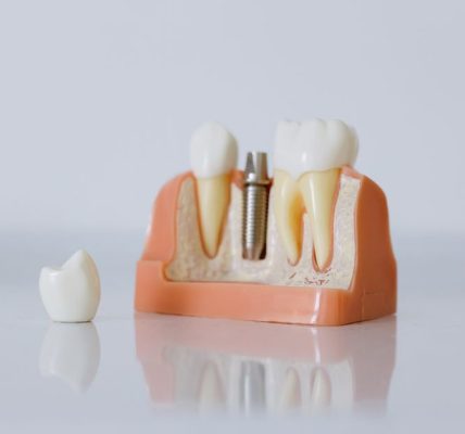 perte de poids après retrait implant