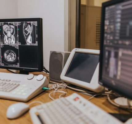 prix IRM avec ordonnance